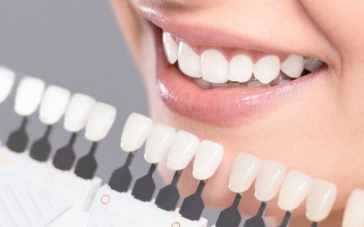How to Care for Your Teeth after Filling