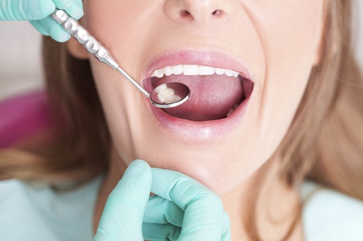 5 Myths That Can Put Your Oral Health At Risk