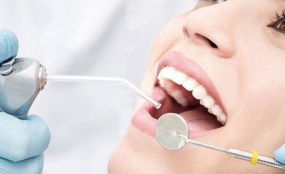 How to Prevent Tooth Fillings If You Have Cavities