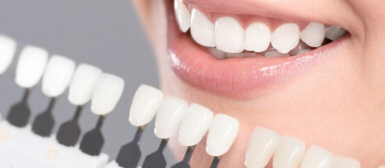 Getting a Dental Crown on Your Tooth
