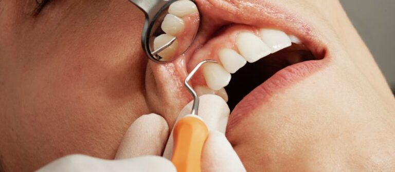6 Ways Stress Can Affect your Oral Health