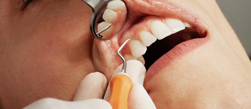 6 Ways Stress Can Affect your Oral Health