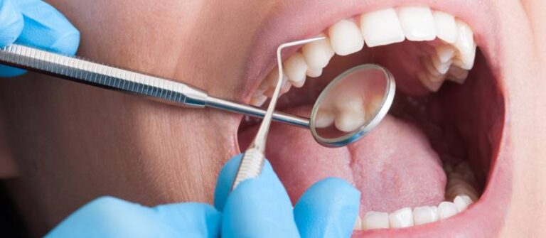 Why Regular Dental Checkups Are the Ultimate New Year’s Resolution